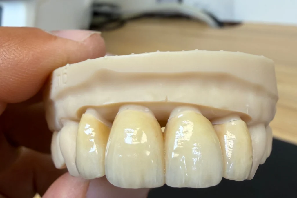 laboratoire dentaire email sante nantes Prothèses fixes Laboratoire Émail Santé