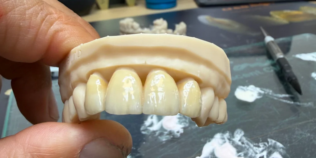 laboratoire dentaire email sante nantes Nos solutions Laboratoire Émail Santé